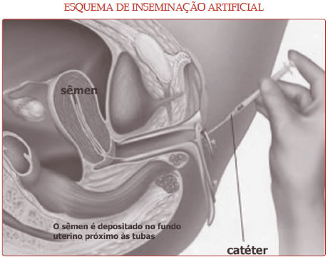 inseminacao