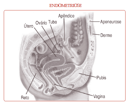 As cirurgias e o comprometimento da fertilidade. Cirurgias do bem e as  cirurgias do mal (Grupo IPGO)